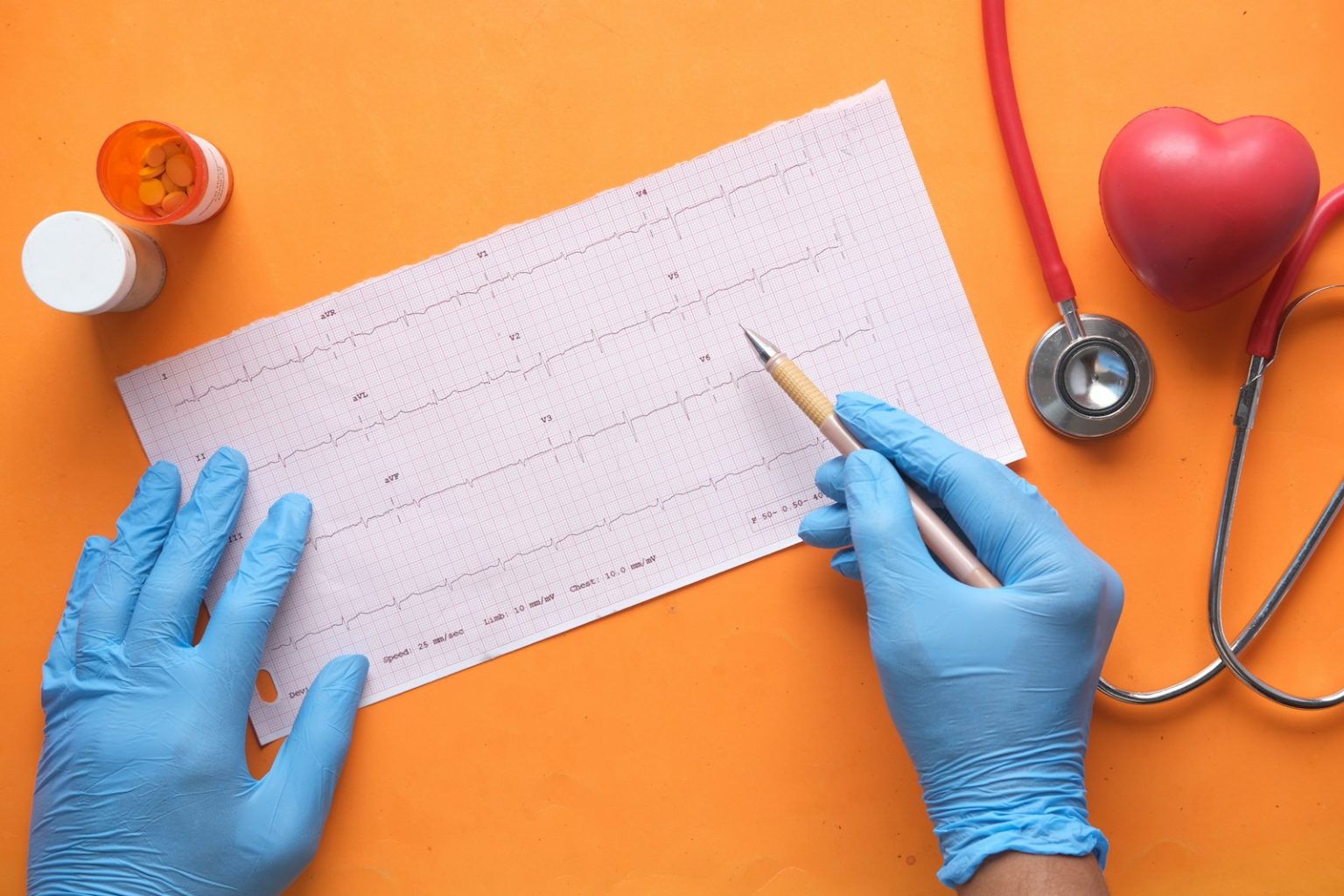 Cms to audit all medicare advantage plans annually